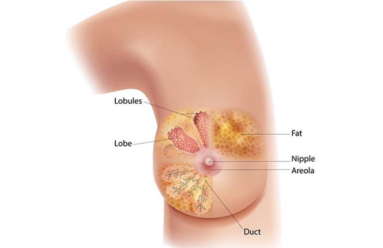 Breast Cancer