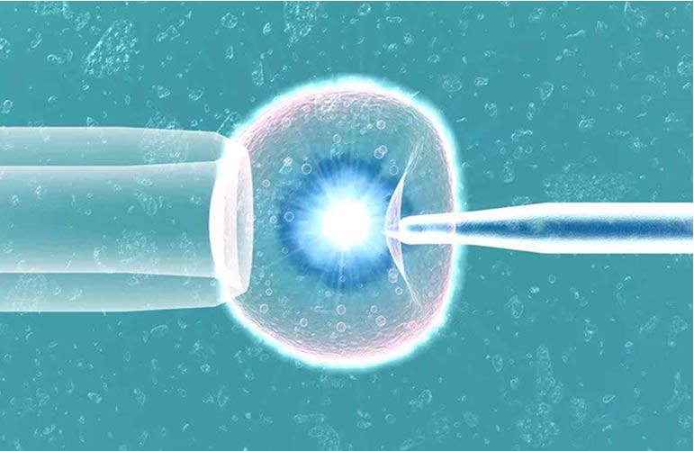 Laser Hatching