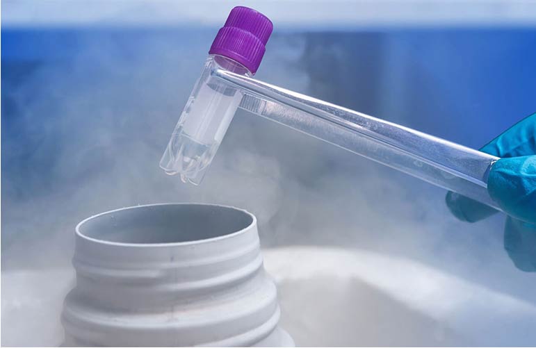 Ovum, Sperm & Embryo Freezing